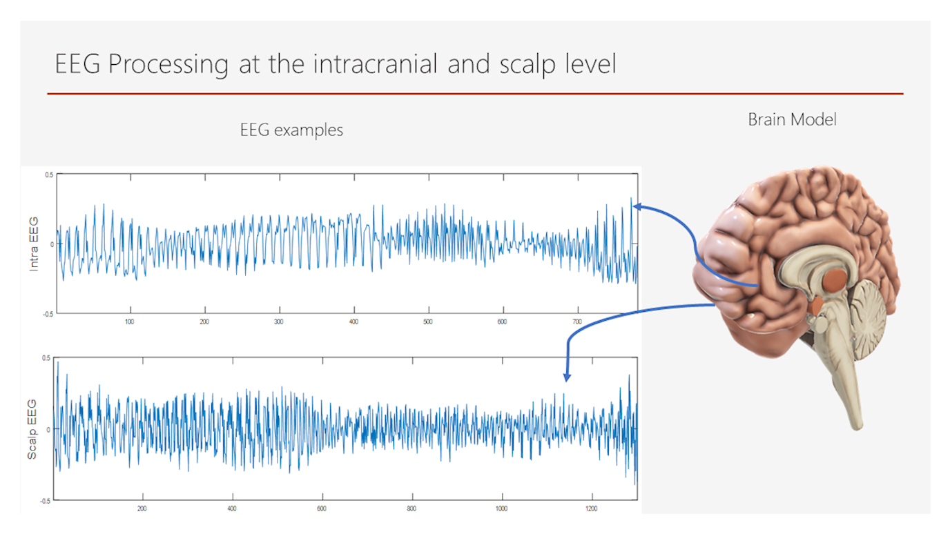 eeg1